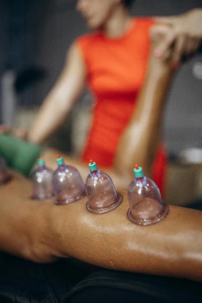 Cupping therapy cups applied during a Hijama session